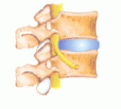 disegno-spinal-unit.gif