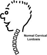 lordosi-cervicale-normale