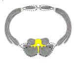 stabilittazione vertebrale