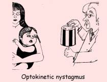 Optokinetic nystagmus